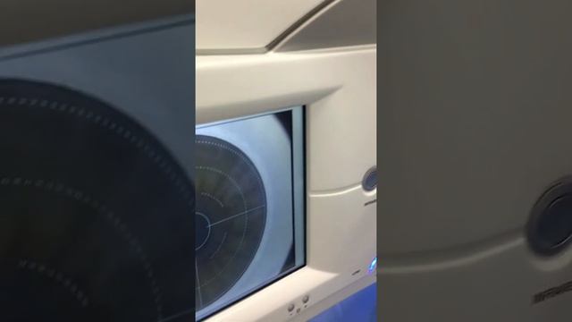 Врачи-офтальмологи тоже делают себе лазерную коррекцию зрения. смотреть онлайн