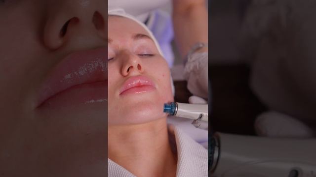 HydraFacial смотреть онлайн