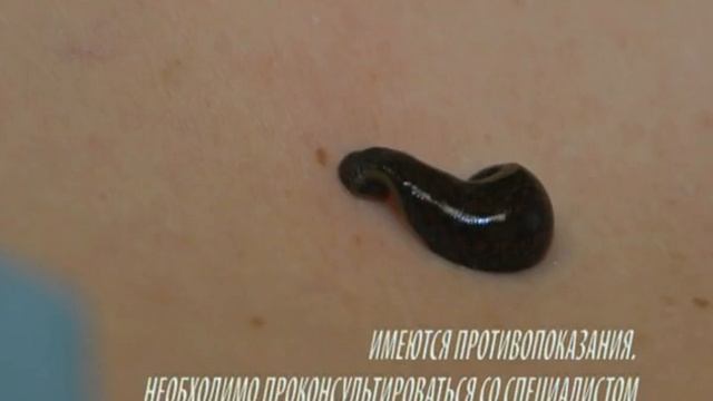 25.02.13 Программа «Эликсир здоровья»