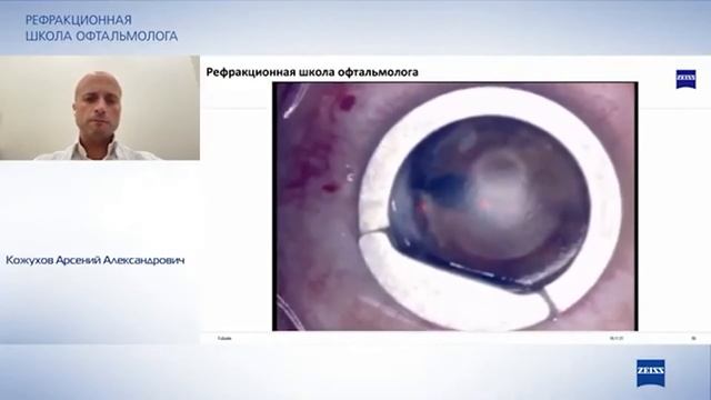 Рефракционная школа офтальмолога. ФРК, ЛАСИК, ФемтоЛАСИК. смотреть онлайн