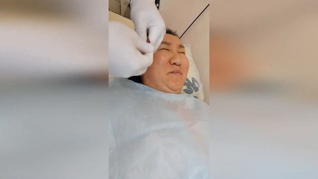 Иглорефлексотерапия при неврите лицевого нерва смотреть онлайн