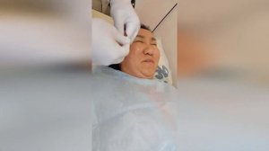 Иглорефлексотерапия при неврите лицевого нерва