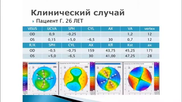 Доклад к.м.н. Полунина: Ортокреатологическая коррекция смешанного астигматизма. Апрель 2022 г. смотреть онлайн