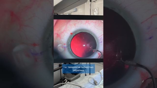 Миопия -12: Как мы вернули 100% зрение с помощью факичных линз! Чудо, ставшее реальностью. смотреть онлайн