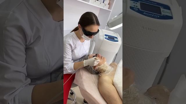 Видалення судин, розацея, пігментації на обличчі. Лікування акне лазерною платформою. смотреть онлайн