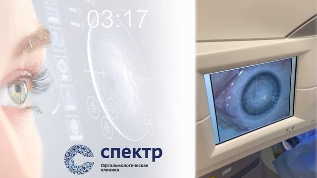 Видео из ЛАЗЕРНОЙ ОПЕРАЦИОННОЙ В РЕАЛЬНОМ ВРЕМЕНИ!!! Мы показали весь процесс коррекции зрения!! смотреть онлайн