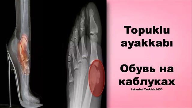 Турецкий язык: Ayakkabılar = Обувь смотреть онлайн