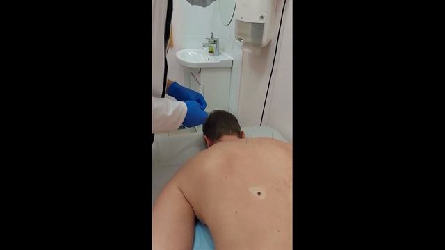 Сочетание баночного массажа с иглорефлексотерапией смотреть онлайн