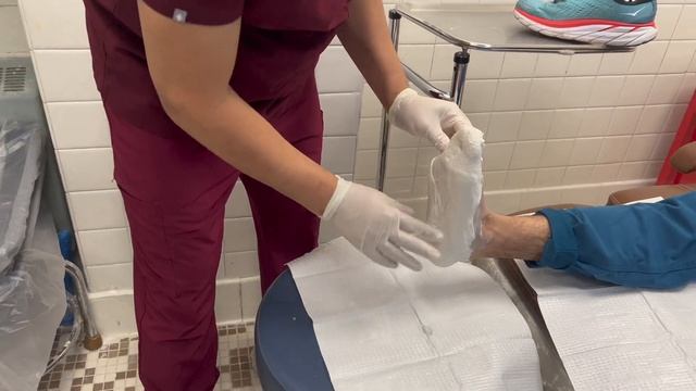 How to make a negative cast for shoe orthotic