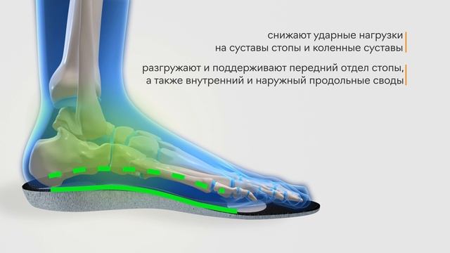 Обзор ортопедической стельки "КОМБИ" с зонами разгрузки, артикул SB07 Talus