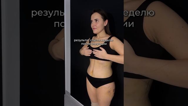 Комплексное преображение фигуры | Бодилифт смотреть онлайн