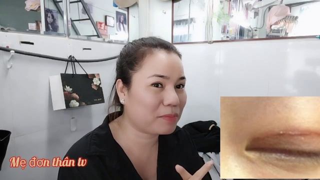 TV 139. Cắt mí mắt | Cách xử lý sẹo sau khi cắt mí - kiêng ăn gì sao phẫu thuật смотреть онлайн