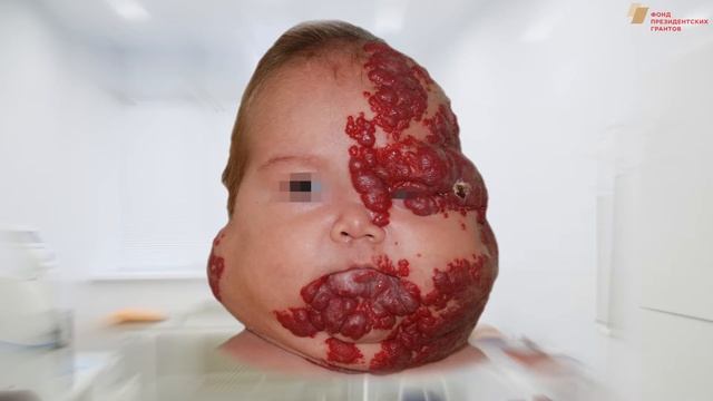 Проект "Опухолей будет меньше" (Поддержан фондом президентских грантов) смотреть онлайн