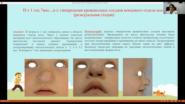 Осложнения при неадекватном лечении сосудистых образований смотреть онлайн