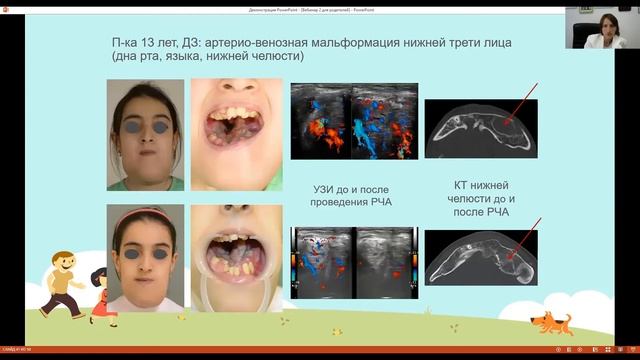 Малоинвазивные методы лечения сосудистых поражений головы, лица и шеи у детей смотреть онлайн