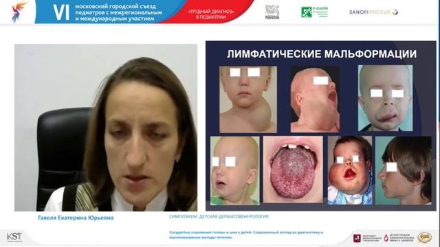 Доклад Е.Ю. Гавели на VI Московском Городском Съезде педиатров “Трудный диагноз” смотреть онлайн