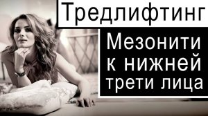 Тредлифтинг - Мезонити к нижней трети лица