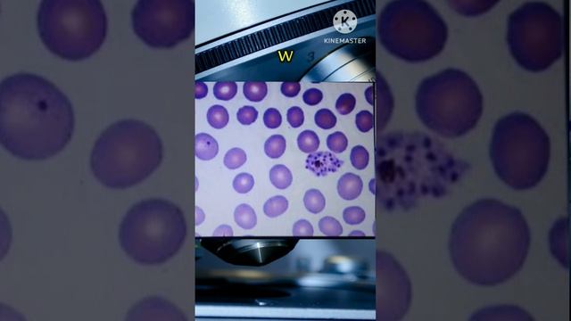 Peripheral Blood Smear # Microscopy # MLT STUDY смотреть онлайн