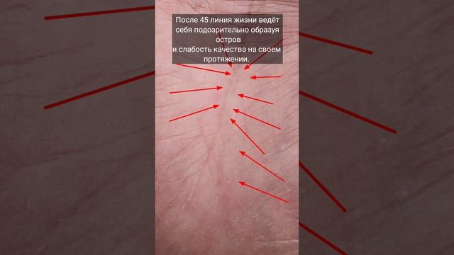 Онкология на ладони женщины. смотреть онлайн