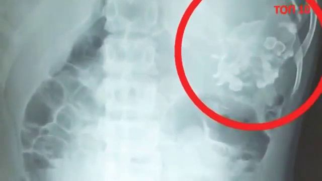 10 terrible mutations МУТАНТЫ смотреть онлайн