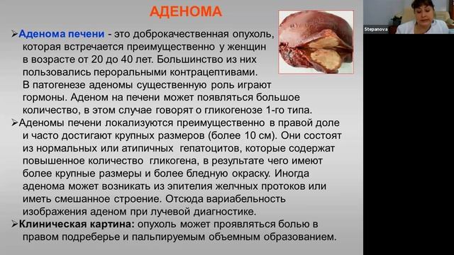 Лекция 11 смотреть онлайн