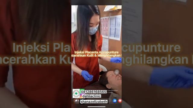 Injeksi Placenta Accupunture @dahliaclinic with dr. @shanazelizabeth. WA: 081286168565 смотреть онлайн