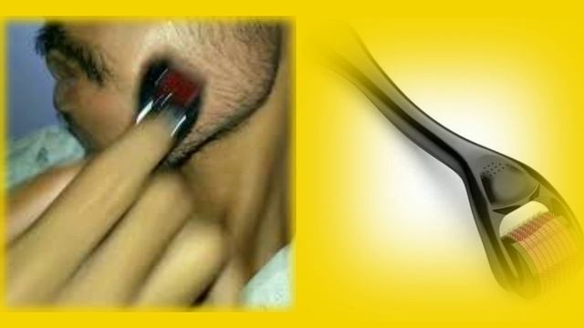Grow full beard by using derma roller | दाढ़ी बढ़ाने के लिए डर्मा रोलर का उपयोग कैसे करें смотреть онлайн