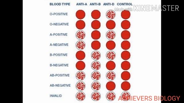 Blood grouping _ABO Typing... Know your blood grouping смотреть онлайн