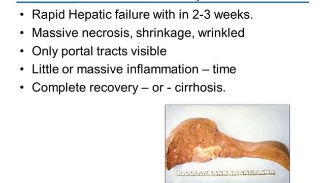 Medical School Pathology Lectures - Year Review-Part 2/4