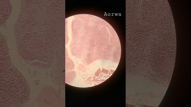 #ospe #histologia #anatomy #mbbs #practical #anatomie смотреть онлайн
