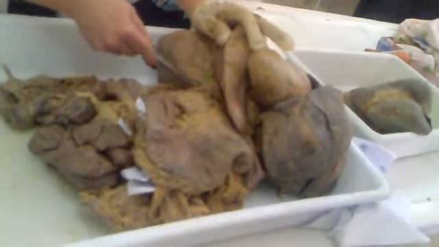 peritoneum смотреть онлайн