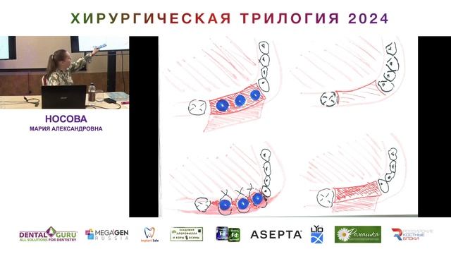 Курс Носовой Марии Александровны. Хирургическая трилогия 2024. Часть 44 смотреть онлайн