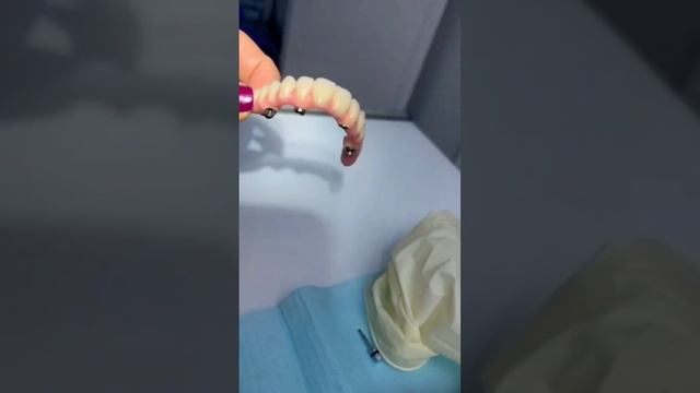 Система "ВСЕ-НА-4" после костной пластики смотреть онлайн