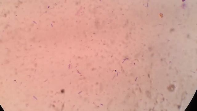Anaerobic bacteria isolation in Microbiology , Clostridium смотреть онлайн