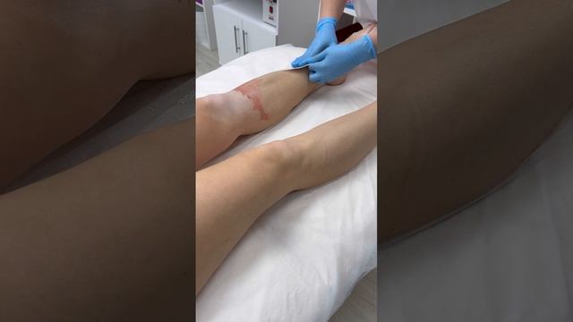 Депиляция картриджным воском ItalWax зоны голеней ног от технолога студии депиляции WAX BAR смотреть онлайн
