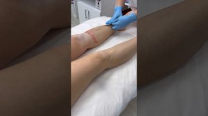 Депиляция картриджным воском ItalWax зоны голеней ног от технолога студии депиляции WAX BAR