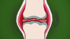 Хондрогард ТРИО