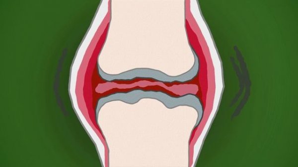 Хондрогард ТРИО