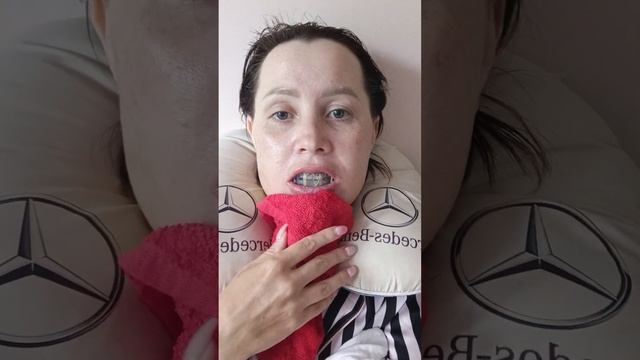 #17 Пятый день после остеотомии челюсти. смотреть онлайн