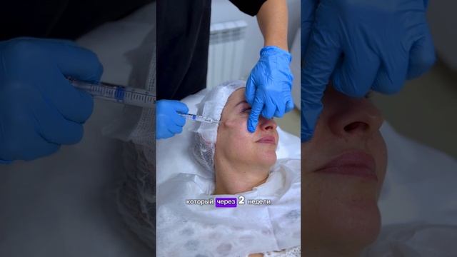 Radiesse 14 смотреть онлайн