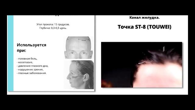 Меридиан желудка смотреть онлайн