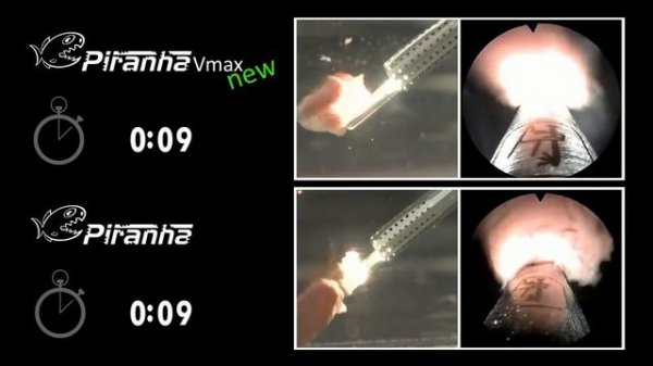 Piranha laser enucleation system from Richard Wolf