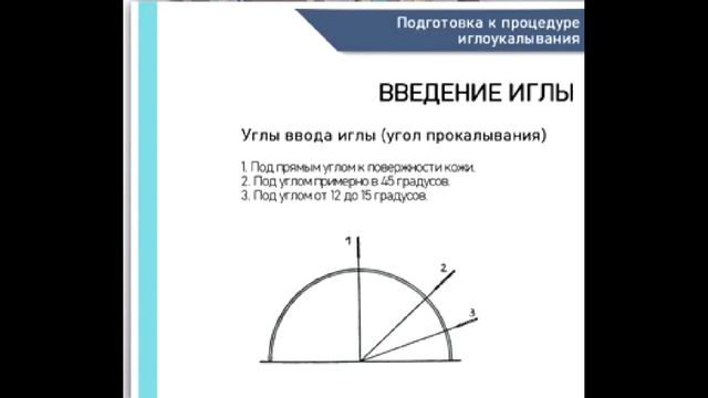 Подготовка к процедуре иглоукалывания смотреть онлайн