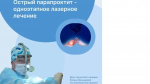 Острый парапроктит - лечение лазером одноэтапно и радикально. #проктолог #парапроктитлазером