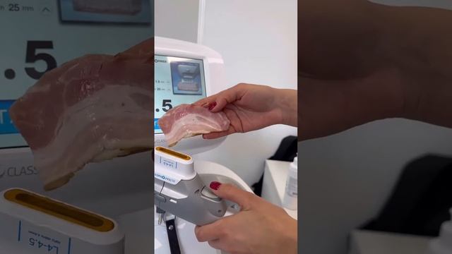 СМАС лифтинг смотреть онлайн