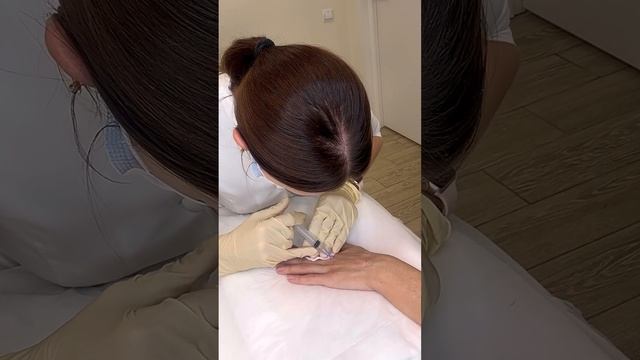 Биоревитализация рук смотреть онлайн