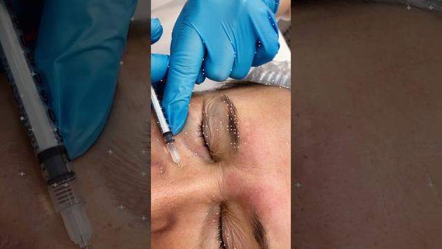 Миотокс смотреть онлайн