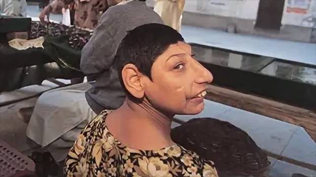 Кто такие "Крысы Шаха Даулы" в Пакистане? Это хуже, чем в Индии! смотреть онлайн