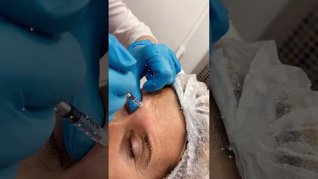 Ботулинотерапия смотреть онлайн