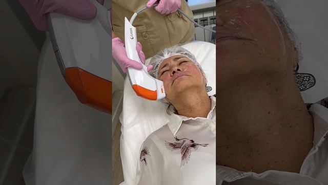 СМАС лифтинг Ultraformer смотреть онлайн